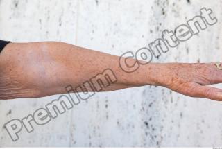 Forearm texture of street references 383 0001